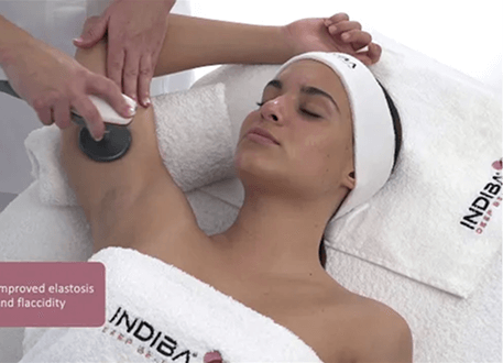 Indiba Body Contouring Image