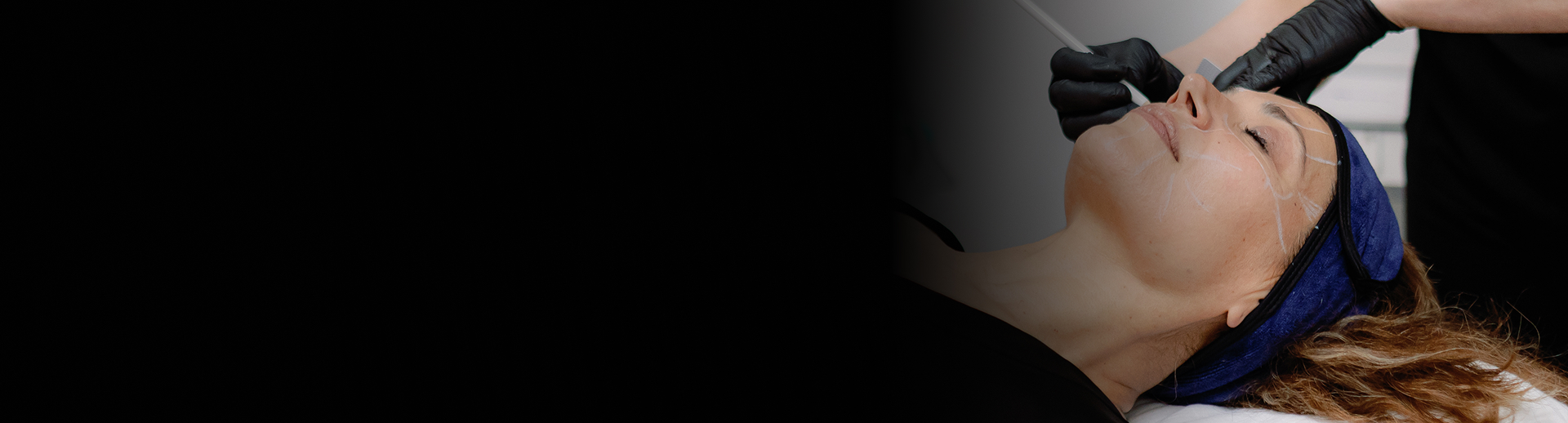 Ultraformer Banner